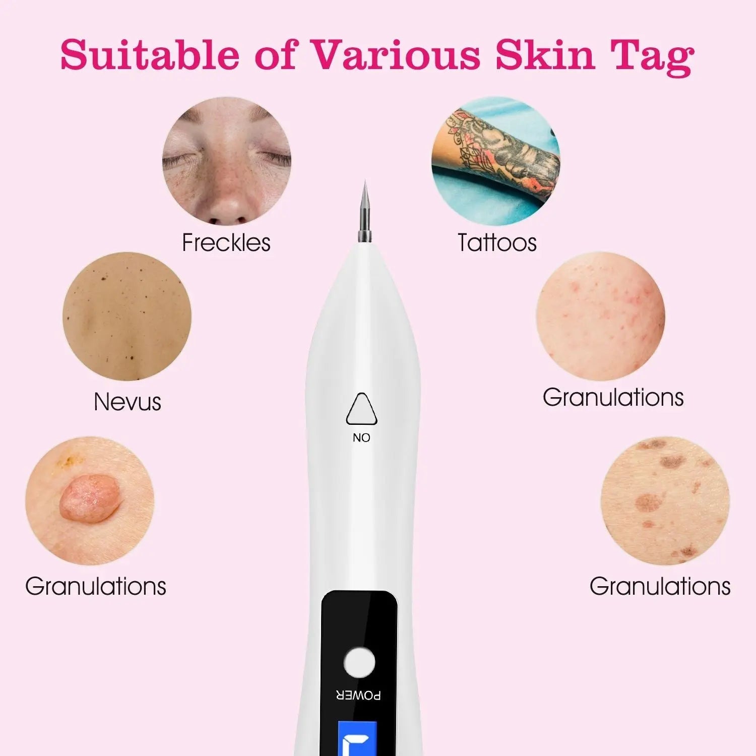 Skin Tag Repair Kit Portable Beauty Equipment Multi-Level with Home Crimson Medea